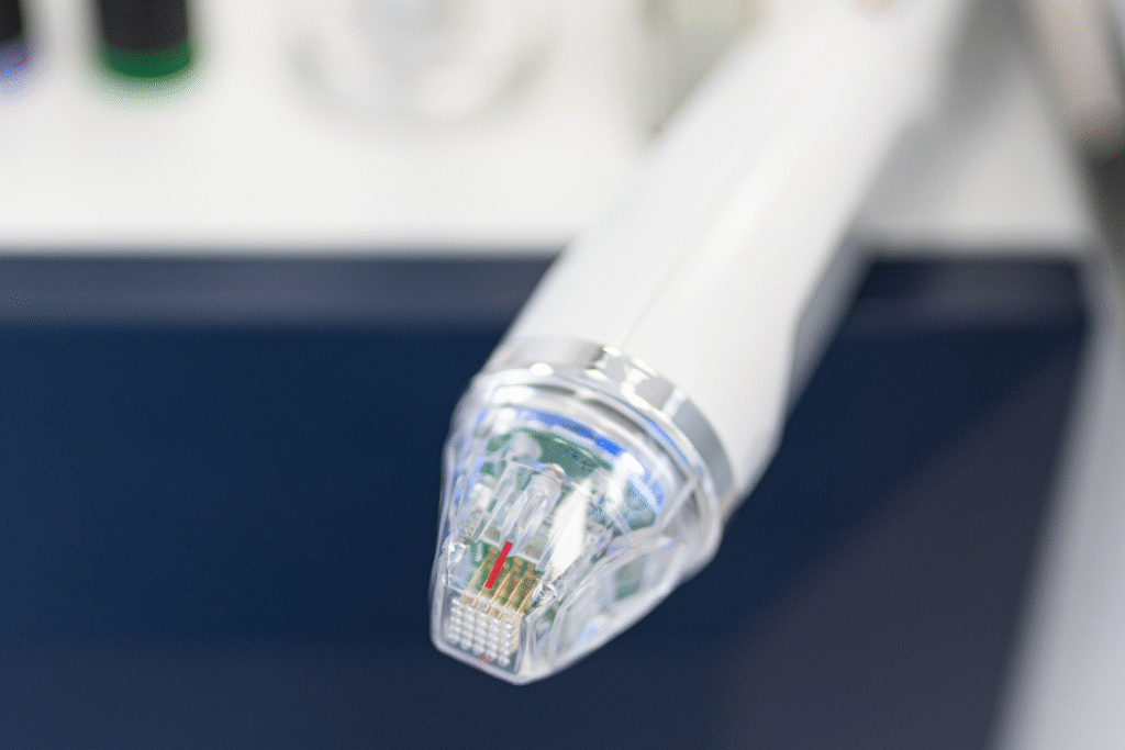 Rozstępy - laser CO2 czy radiofrekwencja mikroigłowa? rozstępy rozstępy