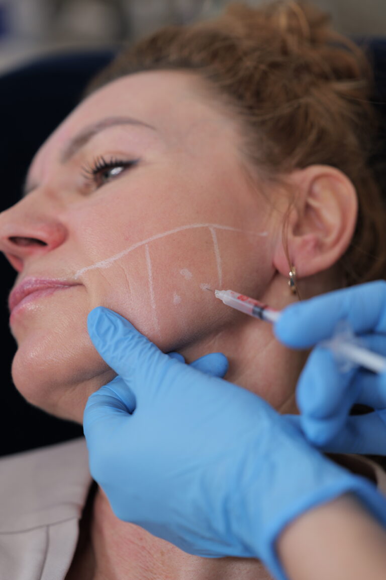 Toksyna botulinowa – Relaksacja bruksizmu