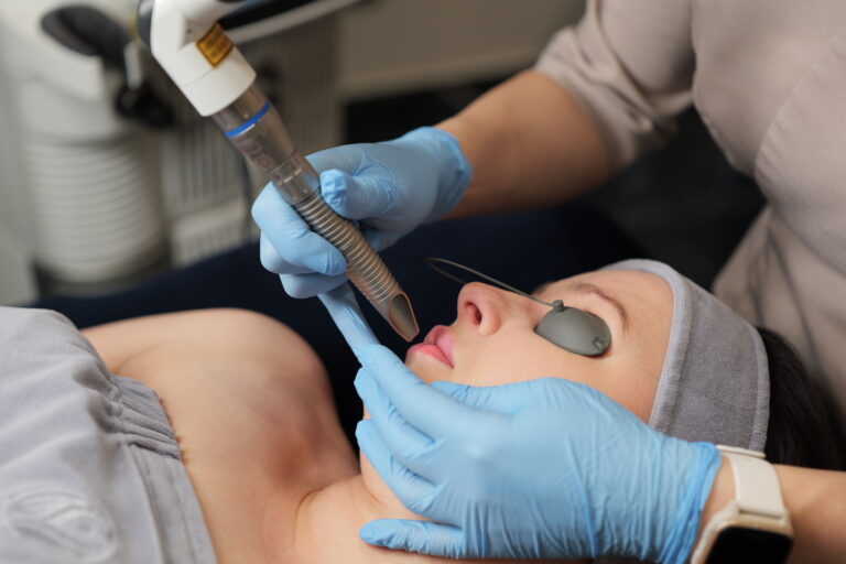 LipLase® Laserowe odmładzanie ust