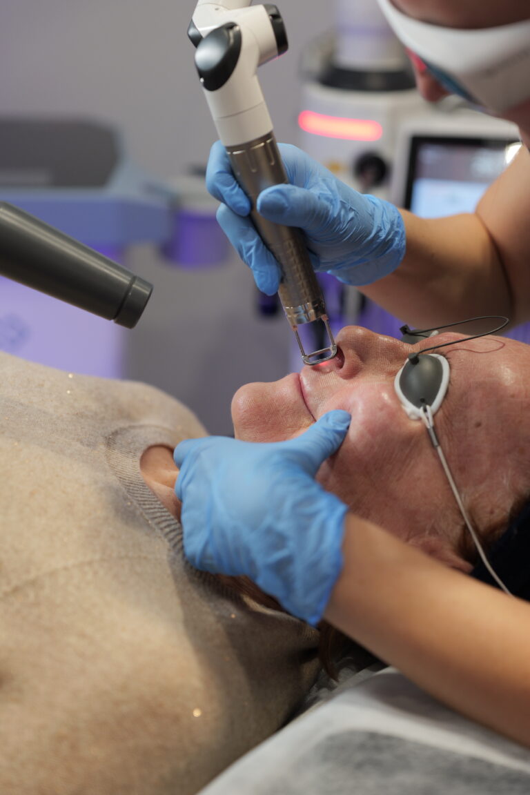 Głęboki resurfacing laserowy Fotona FS01