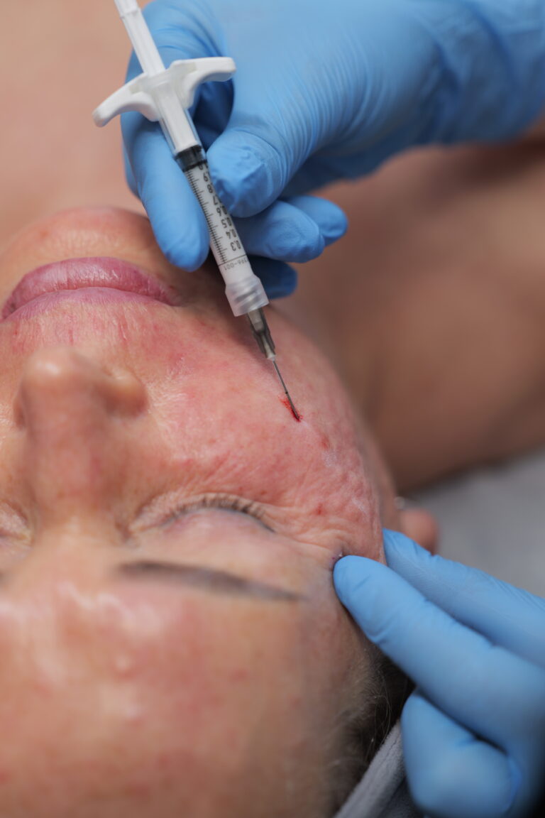 Stymulatory tkankowe