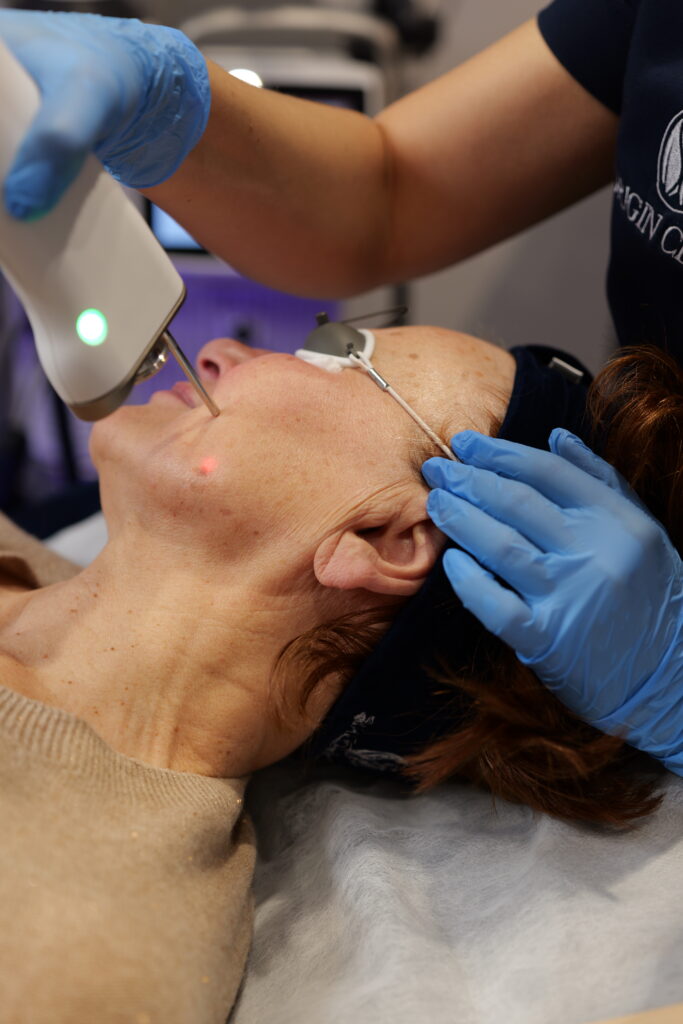 Zabieg laserowy - co trzeba wiedzieć przed ? zabieg laserowy zabieg laserowy